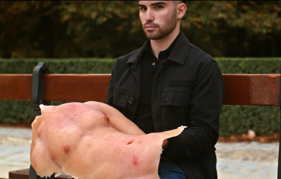 Asociación de Afectados por Dermatitis Atópica (AADA)