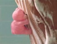 Rexona